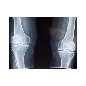 Read more about the article Ways to Improve and Maintain Strong Bones